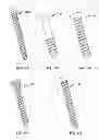 Fig. 69 - Implant components and methods