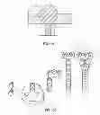 Fig. 70 - Implant components and methods