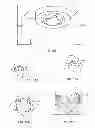 Fig. 72 - Implant components and methods