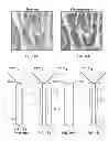 Fig. 74 - Implant components and methods