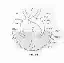 Fig. 75 - Implant components and methods