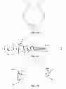 Fig. 80 - Implant components and methods