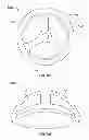 Fig. 83 - Implant components and methods