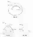 Fig. 84 - Implant components and methods