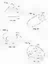 Fig. 85 - Implant components and methods