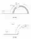 Fig. 90 - Implant components and methods