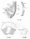 Fig. 91 - Implant components and methods