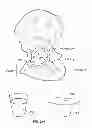 Fig. 93 - Implant components and methods