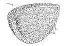 Fig. 01 - Implant components and methods