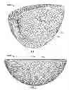 Fig. 02 - Implant components and methods