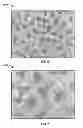 Fig. 04 - Implant components and methods