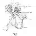 Fig. 03 - Method and prosthesis for percutaneous hernia repair