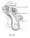 Fig. 09 - Method and prosthesis for percutaneous hernia repair