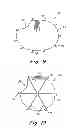 Fig. 10 - Method and prosthesis for percutaneous hernia repair