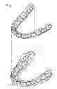 Fig. 01 - Computer automated development of an orthodontic treatment plan and appliance