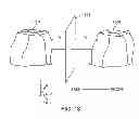Fig. 26 - Computer automated development of an orthodontic treatment plan and appliance