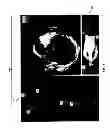 Fig. 06 - Method and apparatus for performing virtual pullback of an intravascular imaging device