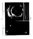 Fig. 08 - Method and apparatus for performing virtual pullback of an intravascular imaging device