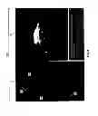 Fig. 09 - Method and apparatus for performing virtual pullback of an intravascular imaging device