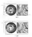 Fig. 07 - Data labeling and indexing in a multi-modality medical imaging system