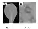 Fig. 08 - Methods Using Acyl-Coenzyme A-Binding Proteins to Enchance Drought Tolerance in Genetically Modified Plants