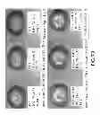 Fig. 76 - Isolated eIF-5A and Polynucleotides Encoding Same