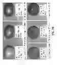 Fig. 79 - Isolated eIF-5A and Polynucleotides Encoding Same
