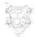 Fig. 02 - Knee pad attachable to a base including rollers and a brake to assist with user movement on a flat surface