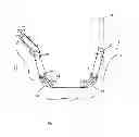 Fig. 02 - Method of assembling a weldment for refuse truck loading arm
