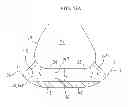 Fig. 35 - Removable rounded midsole structures and chambers with computer processor-controlled variable pressure