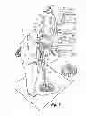Fig. 07 - Digging and backfill apparatus