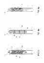 Fig. 05 - Filter provided with structural elements, in particular for a rotary separator