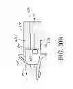 Fig. 55 - Stalk roll with series of flutes having decreasing lengths