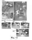 Fig. 15 - Method and apparatus for detection and characterization of mechanical damage
