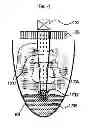 Fig. 04 - CENTRIFUGAL WET TYPE CLEANER