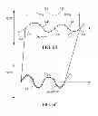 Fig. 06 - METHOD AND APPARATUS FOR TREATING CHEYNE-STOKES RESPIRATION