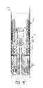 Fig. 07 - Straight-bore back pressure valve