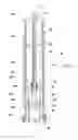 Fig. 02 - Terminations for electrical cables and methods for manufacturing such terminations