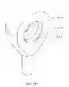 Fig. 239 - Water vapor distillation apparatus, method and system