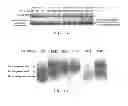 Fig. 02 - Method for diagnosing whether a subject is at high risk for developing atherosclerotic vascular disease