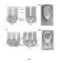 Fig. 03 - Microfluidic devices for multiplexed electrochemical detection