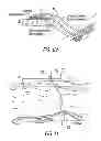 Fig. 11 - Oil spill recovery system and method