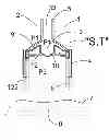 Fig. 01 - SELF CLOSING FLOW CONTROL DEVICE WITH ADJUSTABLE ACTUATOR ELEMENT FOR CONTAINER CLOSURES