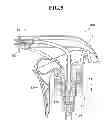 Fig. 06 - Accumulator trigger sprayer and accumulation valve therefor