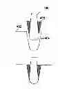 Fig. 01 - Grinding roller comprising hard bodies embedded in the surface