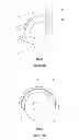 Fig. 02 - Wheel guard for vehicle