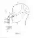 Fig. 02 - Over-molded rotationally coupled assemblies