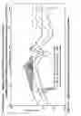 Fig. 07 - Power Transmission in Drilling and related Operations using structural members as the Transmission Line