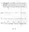 Fig. 22 - Amplifier dynamic bias adjustment for envelope tracking