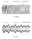 Fig. 33 - Amplifier dynamic bias adjustment for envelope tracking